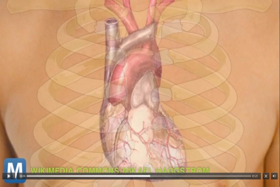 Το 3D εμφύτευμα καρδιάς θα μπορούσε να σώζει ζωές;