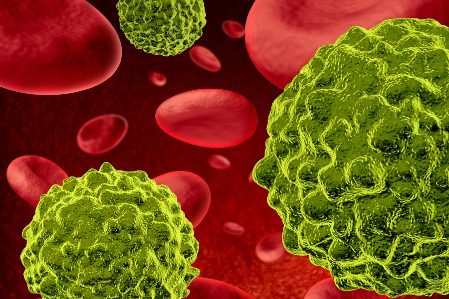 Σουηδοί επιστήμονες ανατινάζουν τα καρκινικά κύτταρα