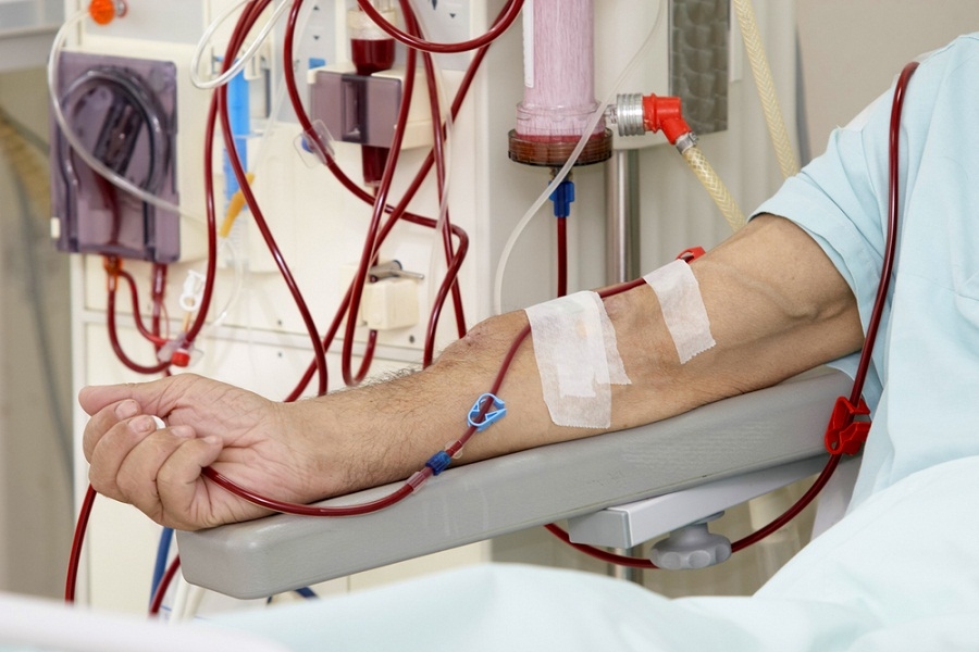 ΕΟΠΥΥ: Παράταση στην κατάθεση των παραστατικών αιμοκαθάρσεων