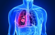 Μέτρια αποτελέσματα του Keytruda στον μικροκυτταρικό καρκίνο του πνεύμονα