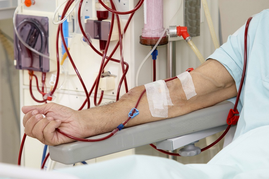 Μεταφορά των ραντεβού αιμοκάθαρσης λόγω αργιών