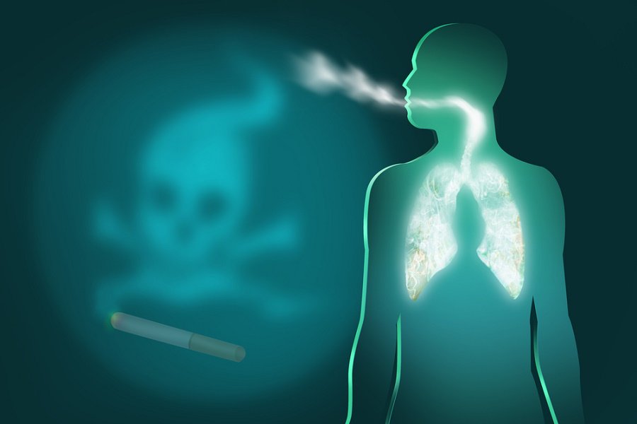 Σύνδρομο αλληλεπικάλυψης άσθματος – ΧΑΠ