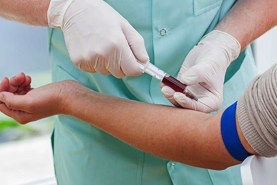 ΠΟΕΔΗΝ: Στους εργαζόμενους το κόστος ελέγχου για αντισωμάτα ιλαράς