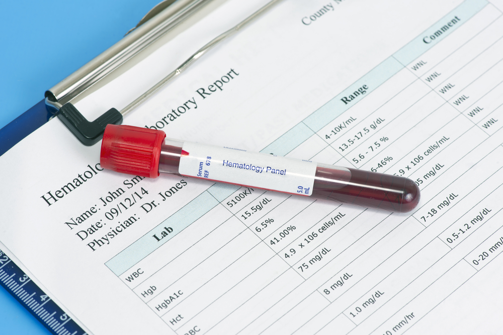 Υποτροφίες σε νέους αιμοτολόγους