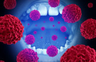 Για πρώτη φορά, μελέτη συνδέει τον καρκίνο στόματος με την ατμοσφαιρική ρύπανση