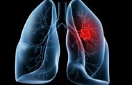 Θετικά νέα για επιθετικό καρκίνο του πνεύμονα