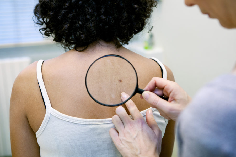 Bristol Myers Squibb: Νέα καμπάνια για τον καρκίνο του δέρματος