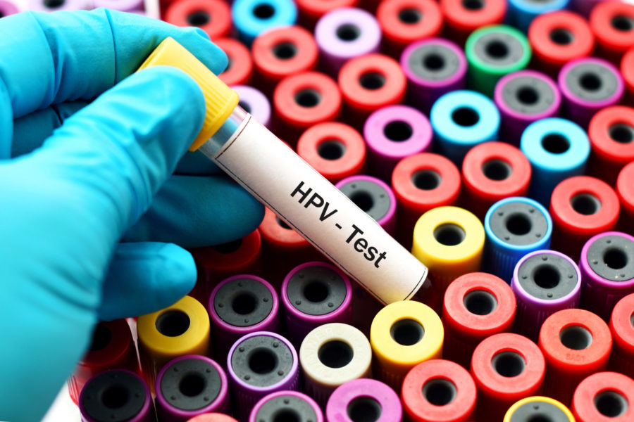 Νέο test για την ανίχνευση της HPV λοίμωξης