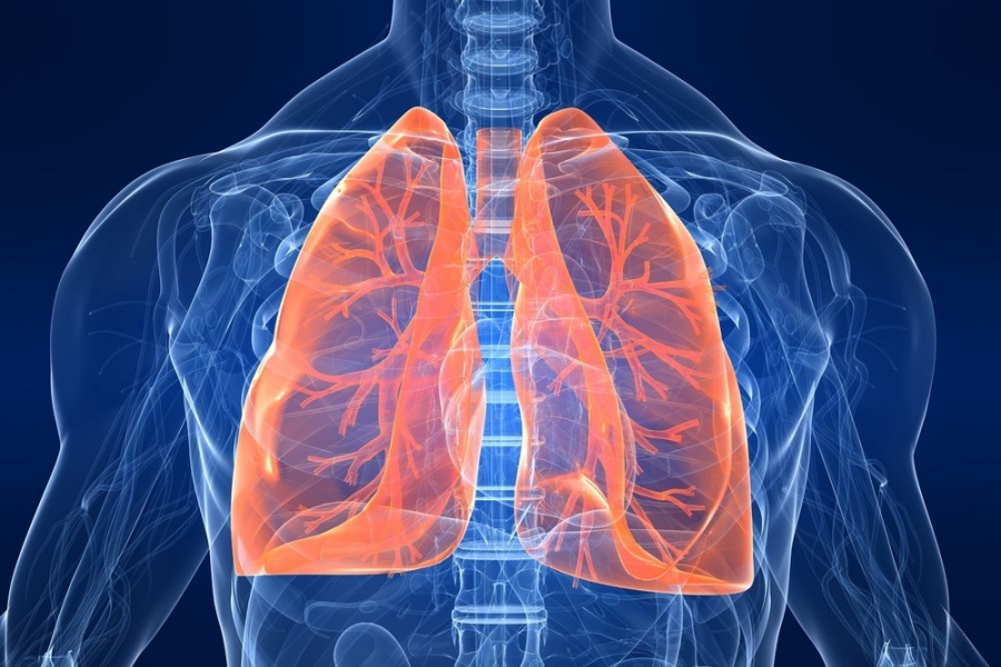 Δραματική καθυστέρηση στη διάγνωση ασθενών για καρκίνο του πνεύμονα λόγω πανδημίας