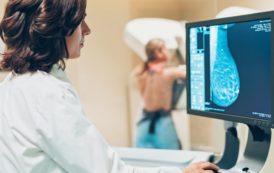 Η μαστογραφία και όλα όσα πρέπει να γνωρίζετε για την πρόληψη του καρκίνου του μαστού    