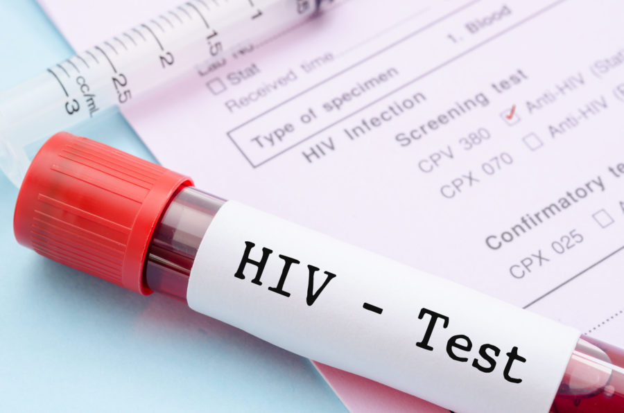 Δωρεάν εξετάσεις για τον HIV για μια εβδομάδα