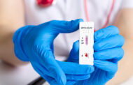 SARS-CoV-2: Πως τα τεστ αντισωμάτων μπορεί να μην εκτιμήσουν σωστά την ανοσία