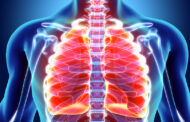 Τι αλλάζει ελάχιστα επεμβατική χειρουργική στον καρκίνο του πνεύμονα