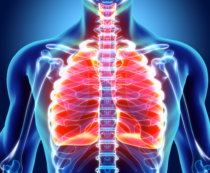 Τι αλλάζει ελάχιστα επεμβατική χειρουργική στον καρκίνο του πνεύμονα