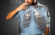 Διακοπή Καπνίσματος: Αύξηση της επιβίωσης σε διαγνωσμένους ασθενείς με καρκίνο του πνεύμονα