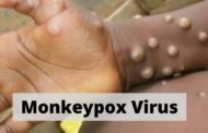 Μόσιαλος: Τι γνωρίζουμε για τον ιό της ευλογιάς των πιθήκων
