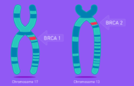Περισσότεροι καρκίνοι προκαλούνται από τα γονίδια BRCA1 & BRCA2!