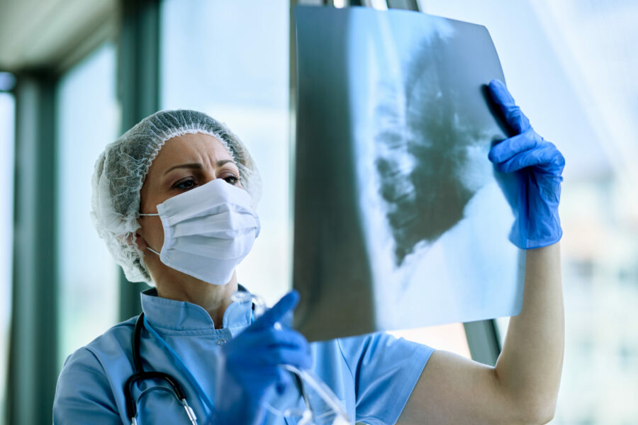 Νέες κατευθυντήριες οδηγίες για την πρόληψη του καρκίνου του πνεύμονα