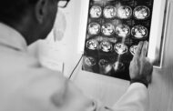 Στην Αθήνα διεθνές εφαρμοσμένο φροντιστήριο για το γλοίωμα εγκεφάλου