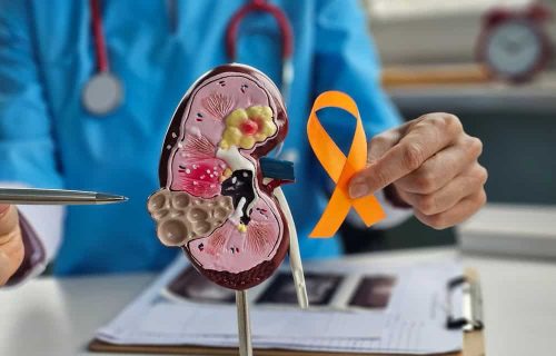 Kidney cancer concept, source: Shutterstock